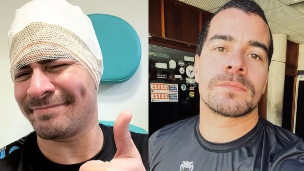 Ator Thiago Martins sofre acidente durante gravações do remake de Cidade de Deus