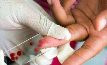 Inteligência Artificial e ciência cidadã são usadas para rastrear vetor da malária em Madagascar